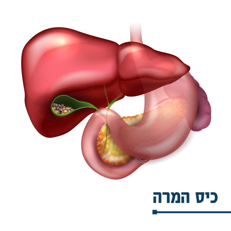 בקע מפשעתי – דר' דביר פרויליך